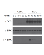 Netrin-1 (human):Fc (human) (rec.) (Prod. No. AG-40B-0075) triggers a DCC-dependent phosphorylation of ERK1/2.<br /> <strong>Method: </strong>HEK 293 cells (Control) or HEK 293 expressing the netrin-1 receptor DCC were incubated with netrin-1 (human):Fc (