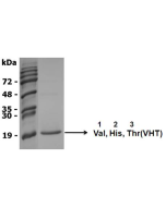 NH<sub>2</sub>-terminal sequence analysis.
