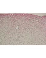 Immunohistochemical staining using anti-Dibromo-tyrosine, mAb (3A5).