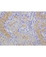 Immunohistochemical staining of cisplatin-treated rat kidney using anti-HEL, mAb (5F12).