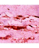 Immunohistochemical staining of MG adducts in atherosclerotic aorta using anti-MG, mAb (3C).