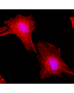 RM217 specifically reacts to human IgG4. No cross reactivity with human IgG1, IgG2, IgG3.