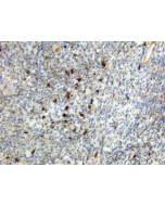 Sandwich ELISA using RM121 as the capture antibody (100ng/well), and Biotinylated anti-human light chains ( κ+ λ) antibody RM129 as the detection antibody, followed by an alkaline phosphatase conjugated streptavidin.