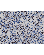 Immunohistochemistry staining of 293T cells expressing His-Tag nuclear protein X, using anti-His-Tag antibody, RM146.