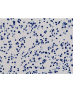 Immunocytochemical staining of HeLa cells, using anti-GAPDH RevMAb Clone RM114 at 1/200 dilution (red). Nuclei have been labeled with DAPI (blue).