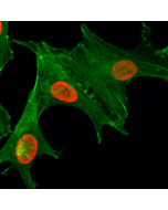 Immunocytochemical staining of HeLa cells treated with sodium butyrate, using anti-Acetyl-Histone H4 (Lys5) Rabbit Monoclonal Antibody (clone RM199) (red). Actin filaments have been labeled with fluorescein phalloidin (green).