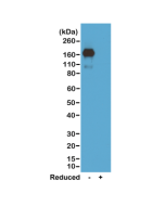 Western blot of nonreduced(-) and reduced(+) mouse IgA, using 0.5ug/mL of RevMAb clone RM220. This antibody reacts to nonreduced IgA.