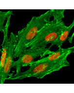 Immunocytochemical staining of HeLa cells treated with sodium butyrate, using anti-Acetyl-Histone H2A.Z (Lys7) Rabbit Monoclonal Antibody (clone RM222) (red). Actin filaments have been labeled with fluorescein phalloidin (green).