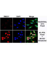 Immunocytochemical staining of HeLa cells using rabbit monoclonal anti-5-mC (clone RM231) antibody (red). Actin filaments have been labeled with fluorescein phalloidin (green), and nuclei stained with DAPI (blue).