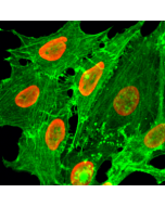 Immunocytochemical staining of HeLa cells treated with sodium butyrate, using anti-Acetyl-Histone H2B (Lys20) Rabbit Monoclonal Antibody (clone RM235) (red). Actin filaments have been labeled with fluorescein phalloidin (green).