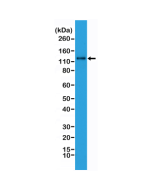Western Blot analysis of HeLa whole cell lysates, using anti-N-cadherin rabbit monoclonal antibody (Clone RM259), showed N-cadherin expression in HeLa cells.