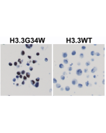 Immunohistochemical staining of formalin fixed and paraffin embedded 293T cells transfected with a DNA construct encoding Histone H3.3 G34W mutant or wild type, stained with anti-Histone H3.3 G34W clone RM263.