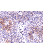 Immunohistochemical staining of formalin fixed and paraffin embedded human Tonsil tissue sections using Anti-Integrin alpha 4 Rabbit Monoclonal Antibody (Clone RM268) at a 1:5000 dilution.