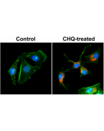 Immunocytochemical staining of HeLa cells untreated or treated with chloroquine (CHQ), using anti-LC3B rabbit monoclonal Antibody Clone RM293 (red) at a 1:200 dilution. Actin filaments have been labeled with fluorescein phalloidin (green), and nucleus lab