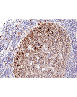 Immunohistochemical staining of formalin fixed and paraffin embedded human tonsil tissue sections, using anti-Ki-67 Rabbit Monoclonal Antibody (Clone RM360) at a 1:1000 dilution.