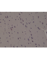 Immunohistochemical staining of formalin fixed and paraffin embedded human brain tissue section using anti-ALK rabbit monoclonal antibody (Clone RM361) at a 1:1000 dilution.