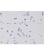 Immunohistochemical staining of formalin fixed and paraffin embedded 293T cells transfected with a DNA construct encoding wild type (WT) proteins of Histone H3, stained with anti-Histone H3 K4M rabbit monoclonal antibody clone RM363.