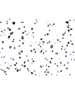 anti-EGFR (L858R) (human), Rabbit Monoclonal (RM380) (Biotin)