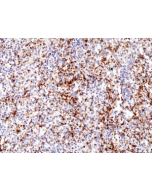 Immunohistochemical staining of formalin fixed and paraffin embedded human spleen tissue section using anti-CD61 rabbit monoclonal antibody (Clone RM382) at a 1:500 dilution.