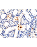 Immunohistochemical staining of formalin fixed and paraffin embedded human stomach using Anti-H.Pylori Rabbit Monoclonal Antibody (Clone RM400) at a 1:100 dilution.