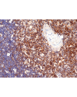 Immunohistochemical staining of formalin fixed and paraffin embedded human liver section using Anti-CD13 Rabbit Monoclonal Antibody (Clone RM403) at a 1:200 dilution.