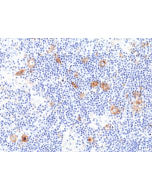anti-CD30 (human), Rabbit Monoclonal (RM425)