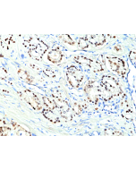 anti-Nkx3.1 (human), Rabbit Monoclonal (RM430)