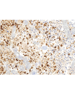 Histone H3.3 Mutation Antibody Panel (G34W, G34R, G34V)