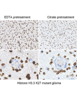 Histone H3 Mutation Antibody Panel (K4M, K9M, K27M, K36M) + H3.3 Mutation (G34W, G34R, G34V)