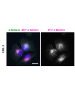 anti-Detyrosinated alpha-Tubulin (human), Rabbit Monoclonal (RM444)