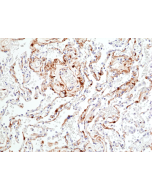 anti-Phospho-p44/42 MAPK (Erk1/2) (Thr202/Tyr204), Rabbit Monoclonal (RM451)