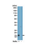 anti-Acetyl-Histone H2B (Lys5), Rabbit Monoclonal (RM455)