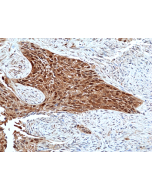 anti-p42 MAPK (Erk2), Rabbit Monoclonal (RM483)