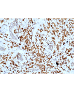 anti-MUC-1 (Mucin-1) (human), Rabbit Monoclonal (RM489)