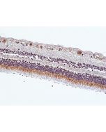 anti-MerTK (human), Rabbit Monoclonal (RM506)