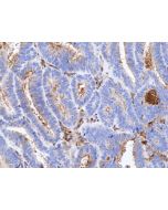 anti-PTEN (human), Rabbit Monoclonal (RM511)