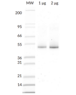 His<sub>6</sub>- Parkin SDS-PAGE. From left to right, increasing amounts of His<sub>6</sub>- Parkin (Prod. No. SBB-CE0055) were loaded onto a 4-20% SDS-PAGE gel and stained with coomassie brillant blue.
