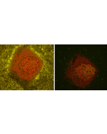 Vector&reg; TrueVIEW&trade; Autofluorescence Quenching Kit