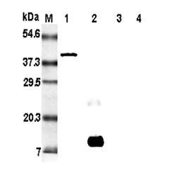 Western blot analysis of resistin using anti-Resistin (rat), mAb (RRES 07) (Prod. No. AG-20A-0015)  at 1:5'000 dilution. <br />1: Rat resistin:Fc fusion protein.<br />2: Recombinant rat resistin protein (His-tagged).<br />3: Recombinant human resistin pro