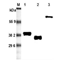 Western blot analysis using anti-Adiponectin (rat), mAb (RADI 264) (Prod. No. AG-20A-0036) at 1:5'000 dilution.<br />1: Rat adiponectin (FLAG<sup>®</sup>-tagged).<br />2: Recombinant rat adiponectin (His-tagged).<br />3: Rat adiponectin Fc-fusion protein.