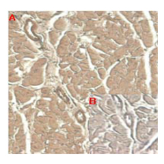 Immunohistochemical staining of human tissue using anti-IL-33 (human), mAb (IL33305B) (Prod. No. AG-20A-0041) at 1:100 dilution.<br />A. Immunoperoxidase staining (cytoplasmic) of formalin-fixed, paraffin-embedded human heart (100x, brown colour).<br />B.
