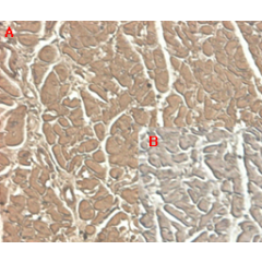 Immunohistochemical staining of human tissue using anti-ST2 (human), mAb (ST33868) (Prod. No. AG-20A-0044) at 1:100 dilution. <br />A. Immunoperoxidase staining (cytoplasmic) of formalin-fixed, paraffin-embedded human heart (100x, brown colour). <br />B. 