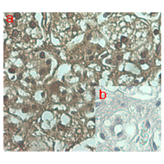 Immunohistochemical staining of human tissue using anti-ANGPTL7 (human), mAb (Kairos 108-4) (Prod. No. AG-20A-0053) at 1:100 dilution. <br />A. Immunoperoxidase staining (cytoplasmic) of formalin-fixed, paraffin-embedded human adrenal gland (200x, brown c
