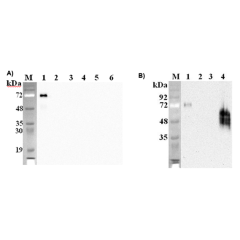 Western blot analysis using anti-DLK1 (mouse), mAb (PF105B) (Prod. No. AG-20A-0057) at 1:2'000 dilution.<br />A)<br />1: Mouse DLK1 Fc-protein.<br />2: Human DLK1 Fc-protein.<br />3: Mouse DLL1 Fc-protein.<br />4: Mouse DLL4 Fc protein.<br />5: Mouse Jagg