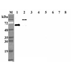 Western blot analysis using anti-DLL1 (human), mAb (D1L165-6) (Prod. No. AG-20A-0074) at 1:2'000 dilution.<br />1: Human DLL1 (FLAG<sup>®</sup>-tagged).<br />2: Human DLL1 Fc-protein.<br />3: Human DLL3 Fc-protein.<br />4: Human DLL4 Fc-protein.<br />5: H