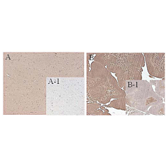 Immunohistochemical staining of mouse FTO using anti-FTO (mouse), mAb (FT62-6) (Prod. No. AG-20A-0083) in mouse tissue (1:500 dilution, 200X).<br />A. Immunoperoxidase staining of formalin-Fixed, paraffin-embedded mouse brain.<br />A-1. Isotype control, m