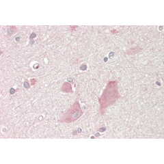 Immunohistochemical staining of NMNAT2 using anti-NMNAT2 (human), mAb (Nady-1) (Prod. No. AG-20A-0087) in human brain cortex tissue (10&micro;g/ml).<br /> This antibody has been tested in immunohistochemistry, analyzed by an anatomic pathologist and valid
