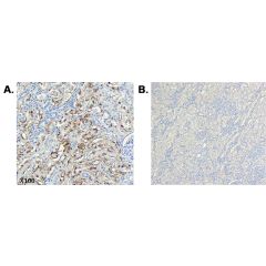 Immunohistochemical staining of CTRP6 using anti-CTRP6 (human), mAb (256-E) (Prod. No. AG-20A-0093) in human tissue.<br /> <b>Method:</b> A. Paraffin-embedded human kidney tissue, showing stained cell cytoplasm using anti-CTRP6 (human), mAb (256-E) at dil