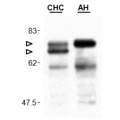 Cardif is cleaved in liver of a patient infected by the hepatitis C virus. 
Protein extracts of liver biopsies from a patient with chronic hepatitis C (CHC) and as a control from a patient with alcoholic hepatitis (AH) were run on a SDS-gel and revealed 