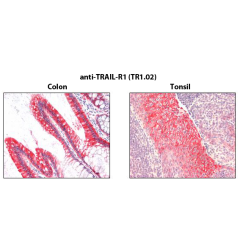 Immunohistochemistry detection of endogenous TRAIL-R1 in paraffin-embedded human carcinoma tissues (colon, tonsil) using mAb to TRAIL-R1 (TR1.02) (Prod. No. AG-20B-0027).